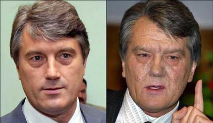 Viktor Yushchenko - August 2004 versus October 2004 <font size=-2>(Source: AFP)</font>