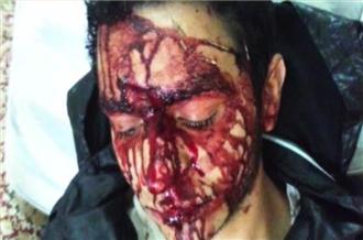 Protester allegedly beaten after appearing on al-Jazeera