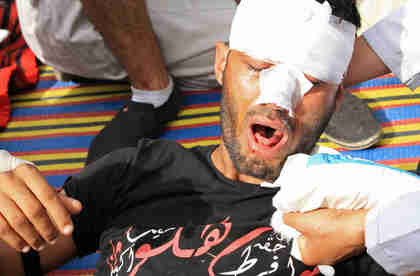 A young protester wounded by army attacks on Friday (Al-Ahram)