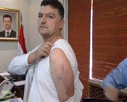 Jasem Kaser, engineer on the  intercepted Syrian Air passenger plane, showing where he was beaten. (AFP)